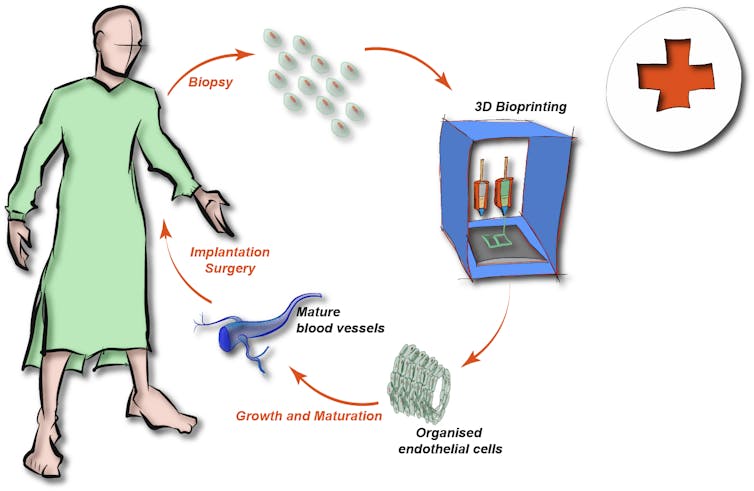 Edible seaweed can be used to grow blood vessels in the body