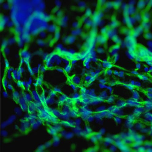 Edible seaweed can be used to grow blood vessels in the body