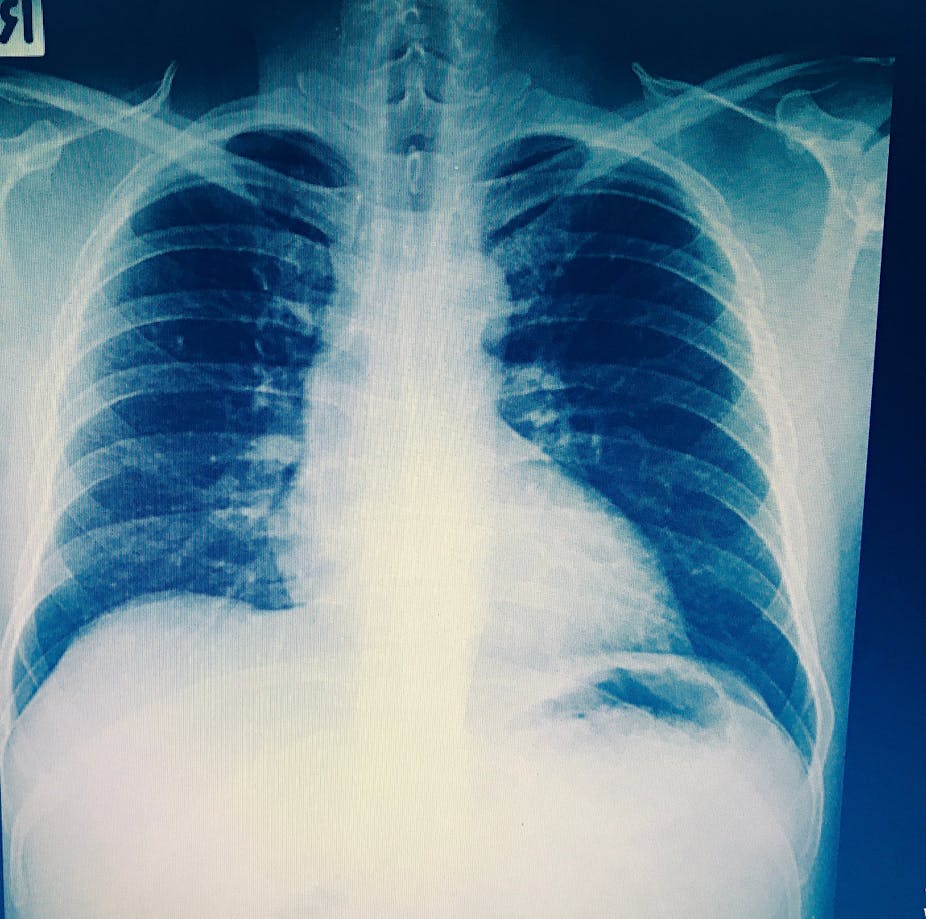 Get Scientists Are Developing New Exciting Strategies For The Fight Desktop Wallpaper Wallpaper Scientists Are Developing New Exciting Strategies For The Fight For iPhone