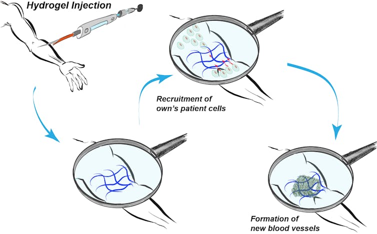 Edible seaweed can be used to grow blood vessels in the body