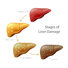 Kids exposed to flame retardant PBDE are at risk for lifelong liver or cardiovascular problems