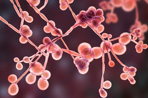 Explainer: what is Candida auris and who is at risk?