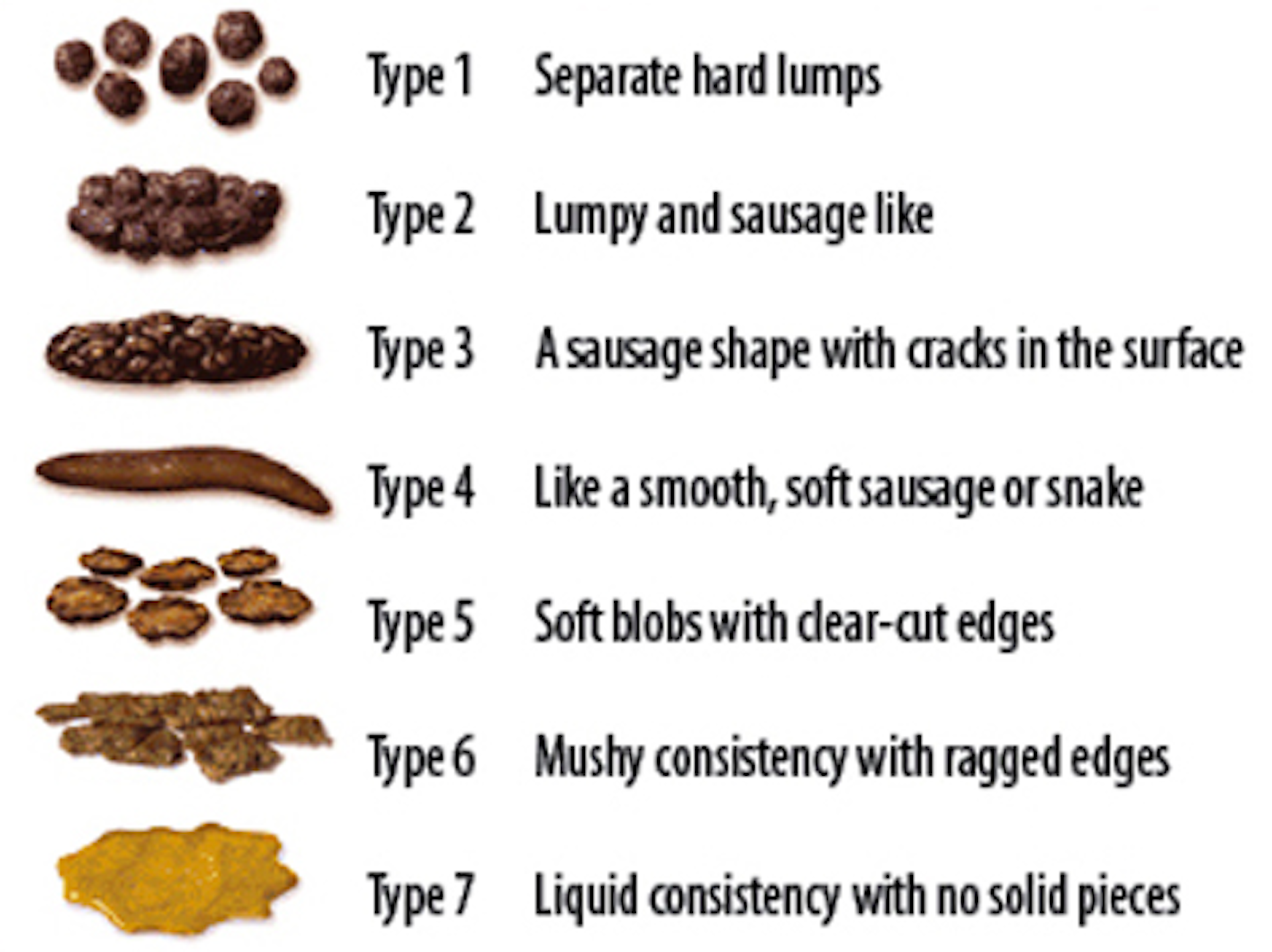 Health Check What Causes Constipation   File 20190417 139101 Vrfxqv 