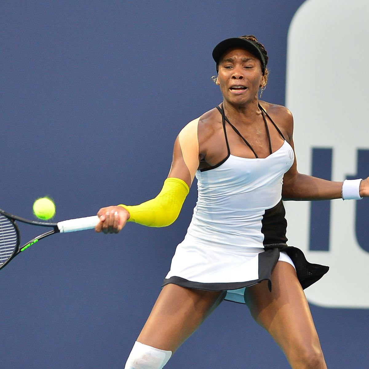 Explainer What Is Sjogren S Syndrome The Condition Venus Williams Lives With Explainer What Is Sjogren S Syndrome The Condition Venus Williams Lives With