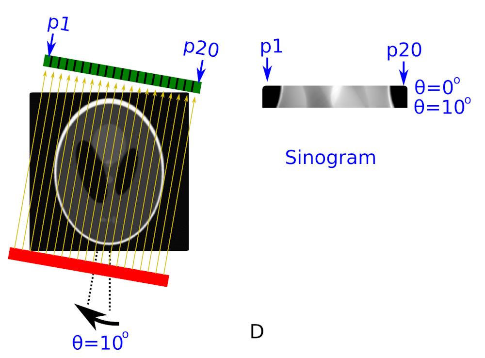 The science of medical imaging: X-rays and CT scans