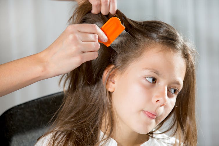 Curious Kids: what's the point of nits?!