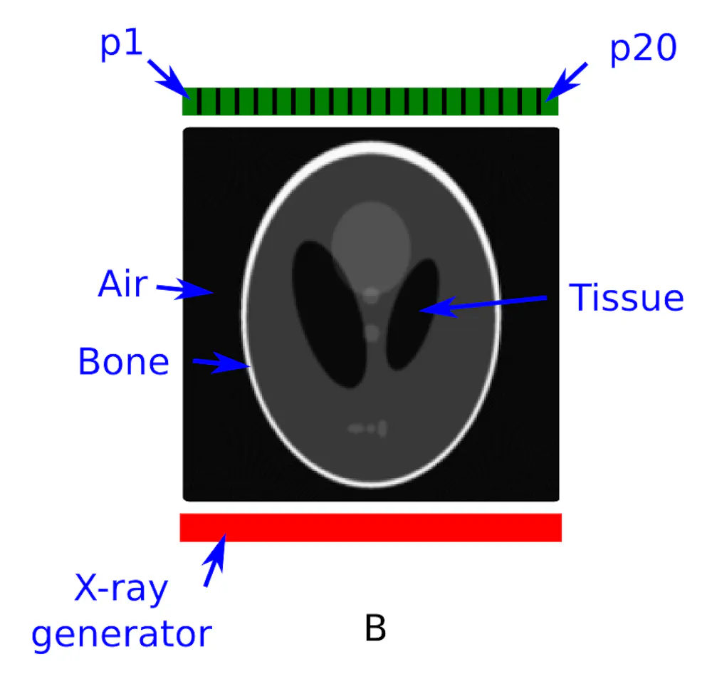 The science of medical imaging: X-rays and CT scans
