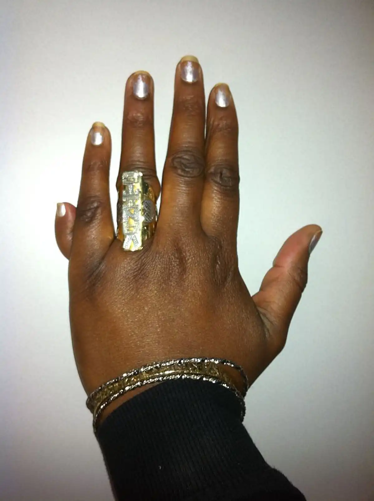 Some bodies contain mysterious variations – here are some examples