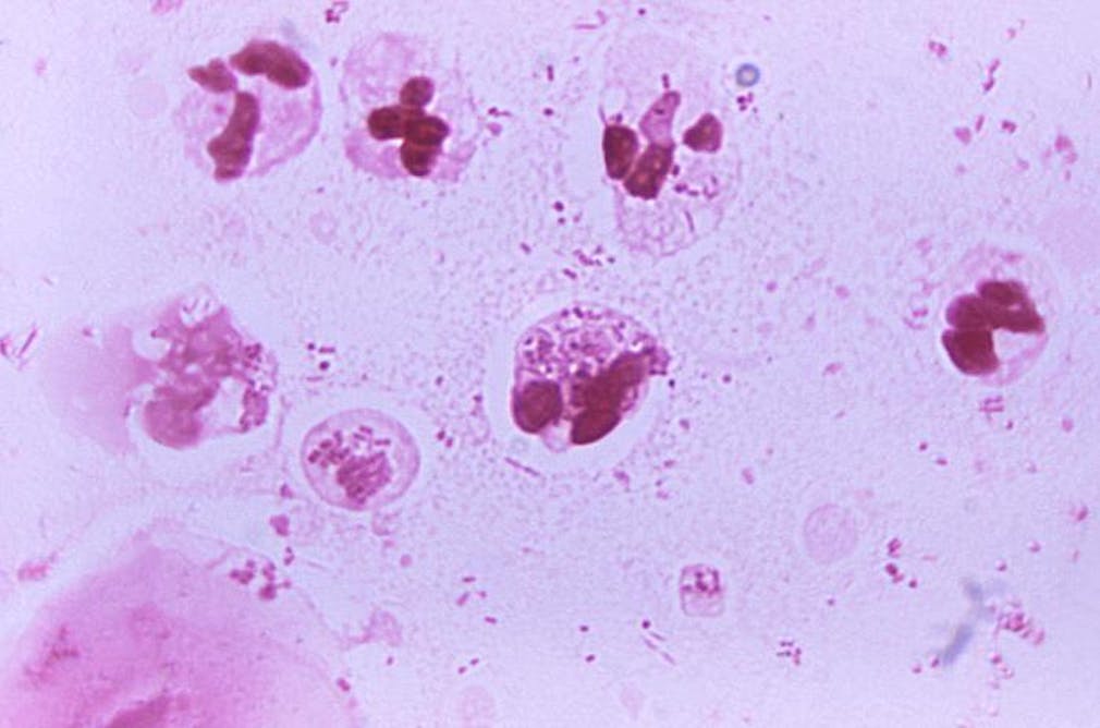 Chlamydia trachomatis neisseria gonorrhoeae. Нейссерии микробиология. Микроорганизм гонорея.