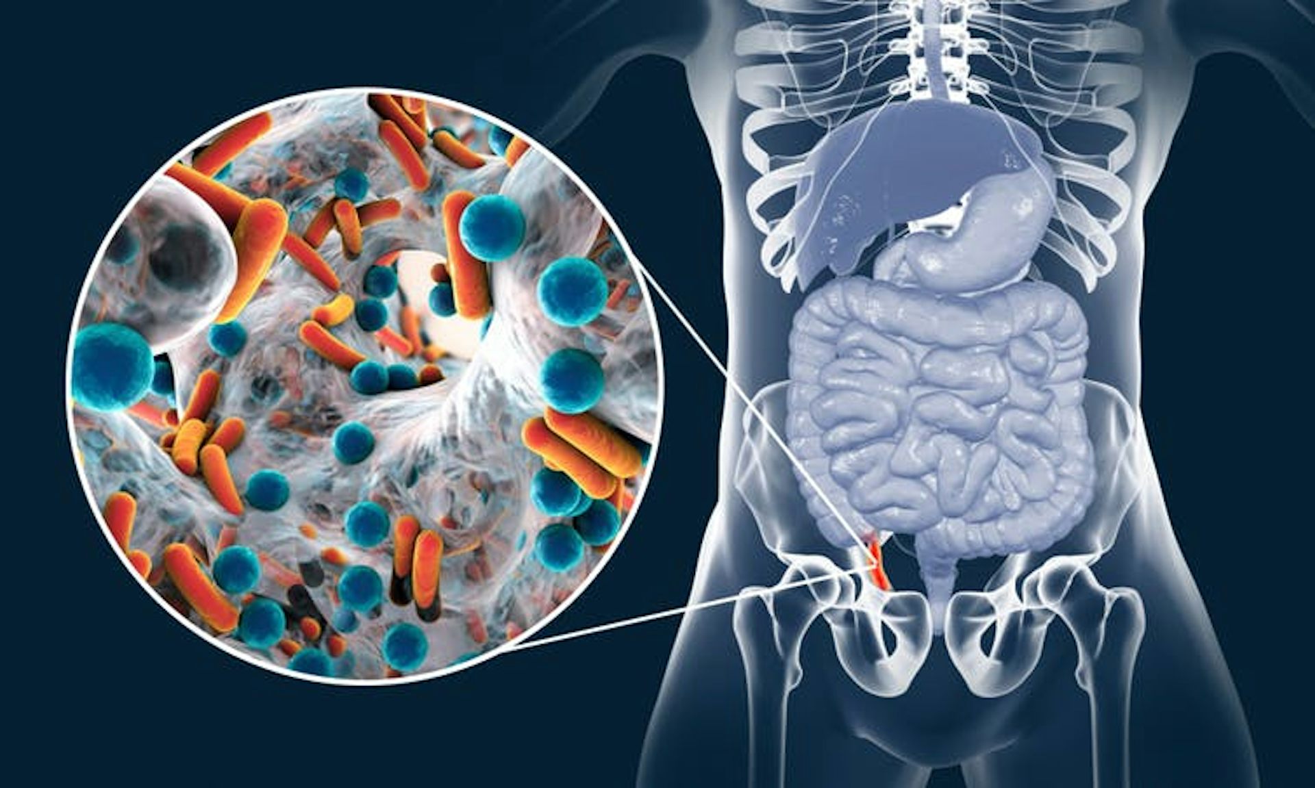 how to tell if your appendix burst