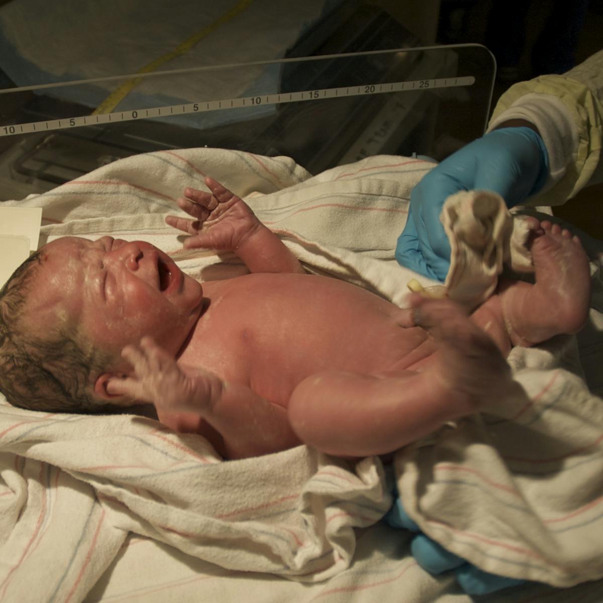 This is what happens to a baby's body during birth