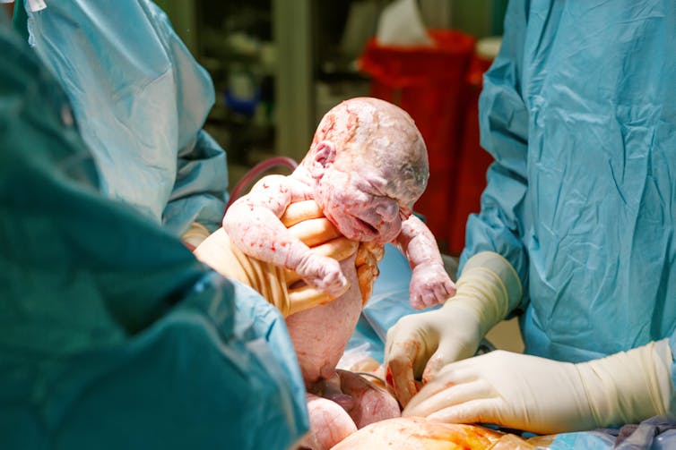 This is what happens to a baby's body during birth