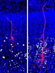 New autism research on single neurons suggests signaling problems in brain circuits