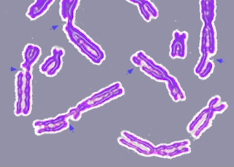 An outlaw yeast thrives with genetic chaos – and could provide clues for understanding cancer growth