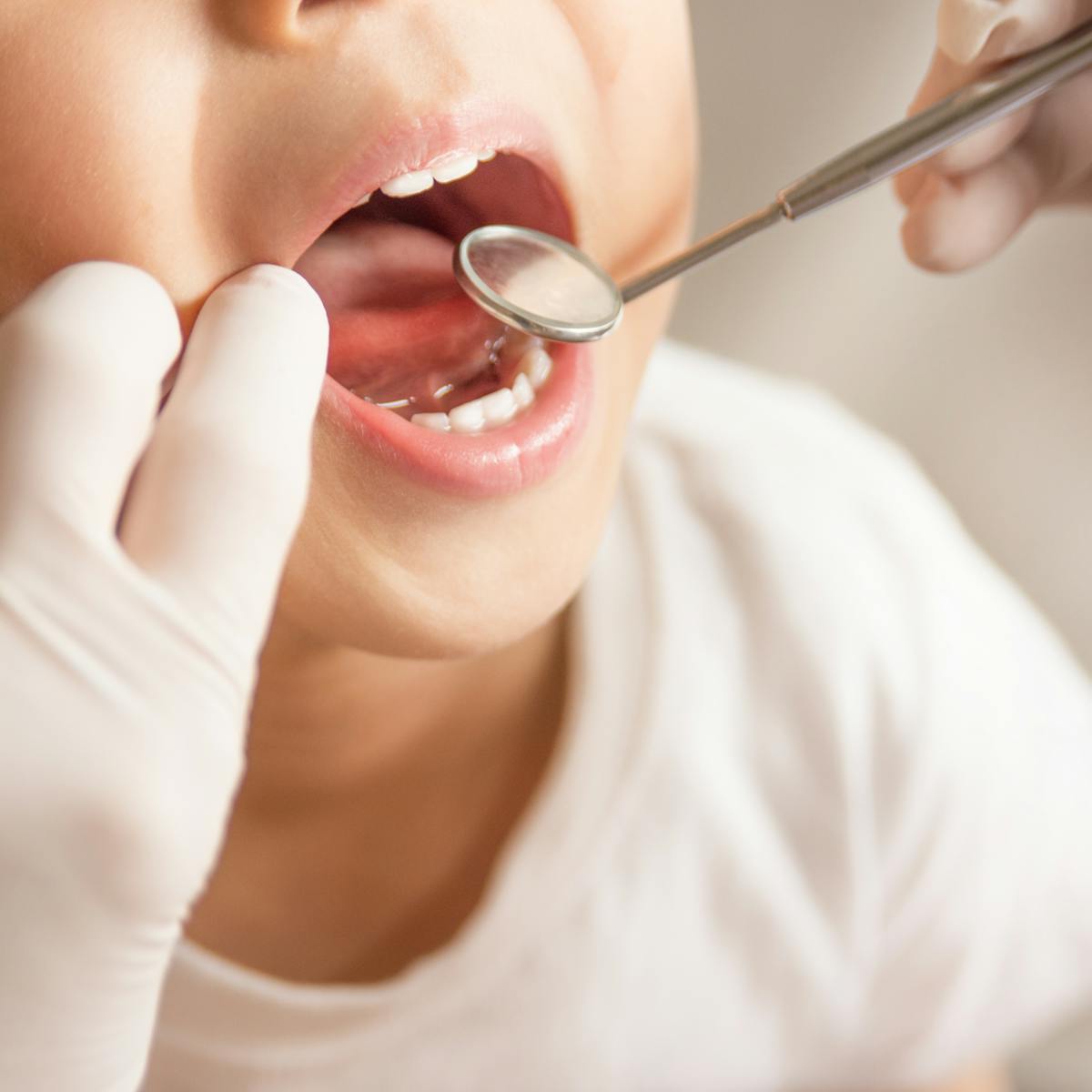 High cost means more than half of NZ's young adults don't access dental care
