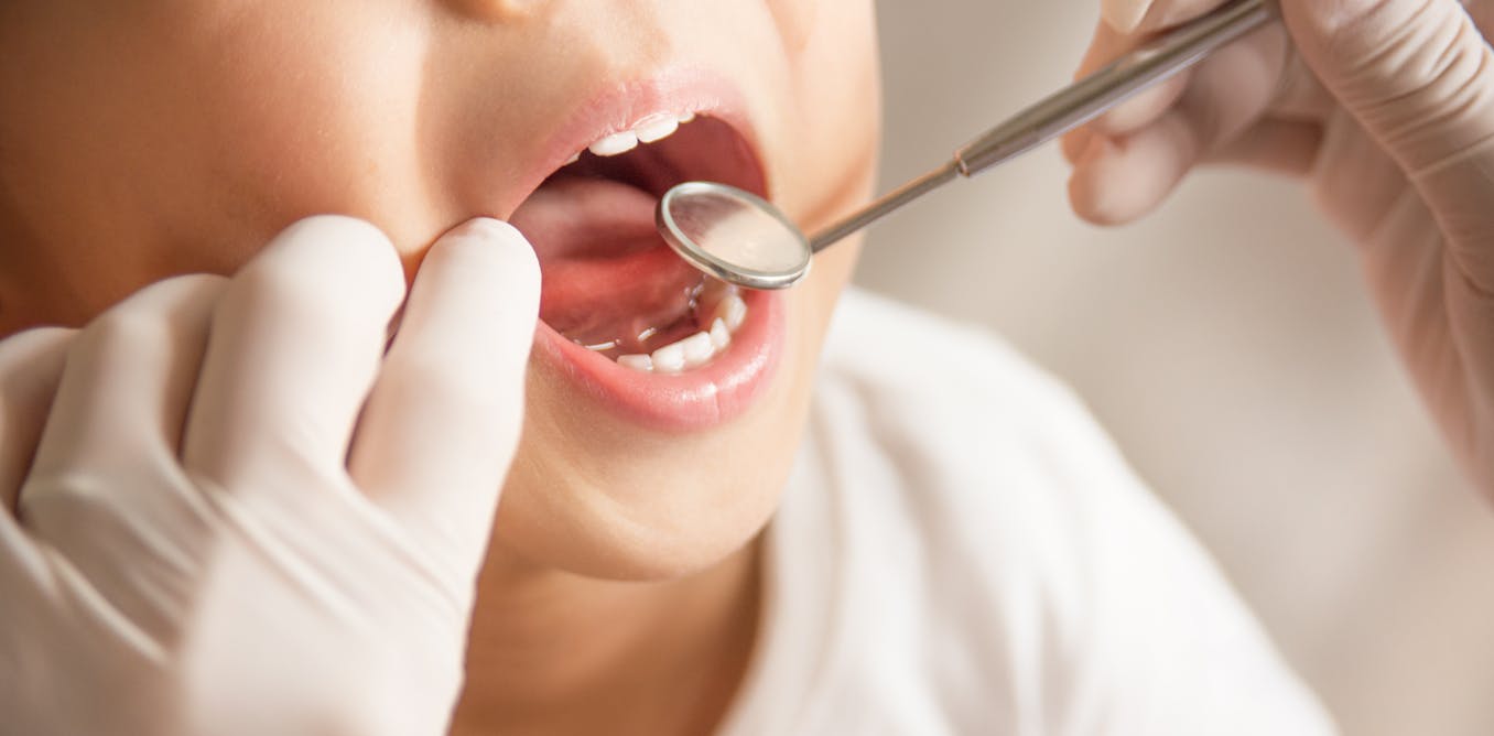 High cost means more than half of NZ's young adults don't access dental care