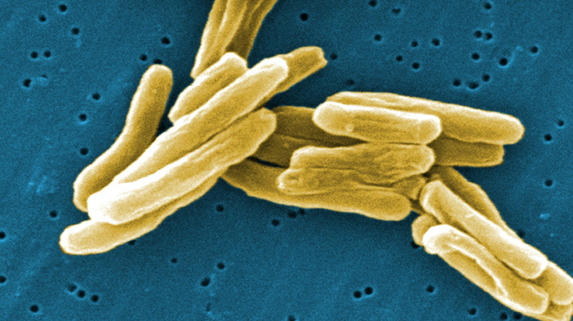 Badger cull: why we must keep a close eye on animal health