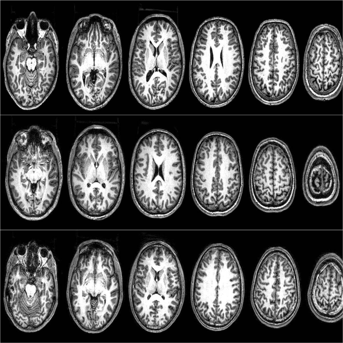The Neuroscience Of Terrorism How We Convinced A Group Of Radicals To Let Us Scan Their Brains The Neuroscience Of Terrorism How We Convinced A Group Of Radicals To Let Us Scan Their Brains