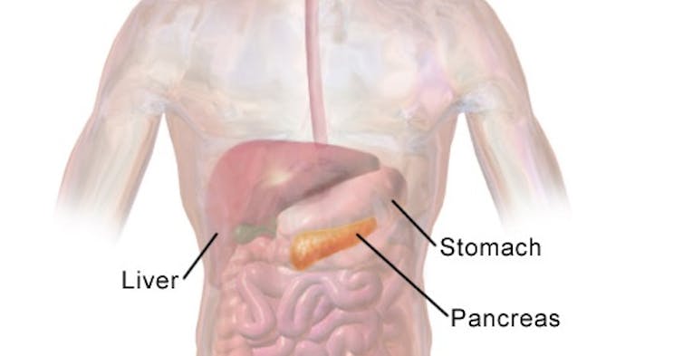 Pancreatic cancer specialist explains challenges of the disease and treatment advances