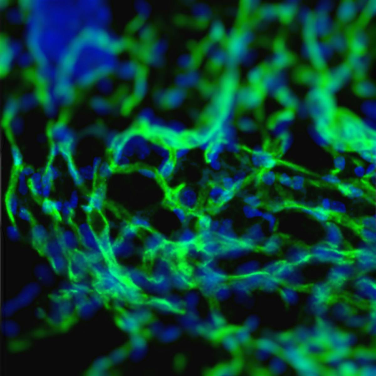 Rumput Laut Bisa Merangsang Pertumbuhan Pembuluh Darah Rumput Laut Bisa Merangsang Pertumbuhan Pembuluh Darah