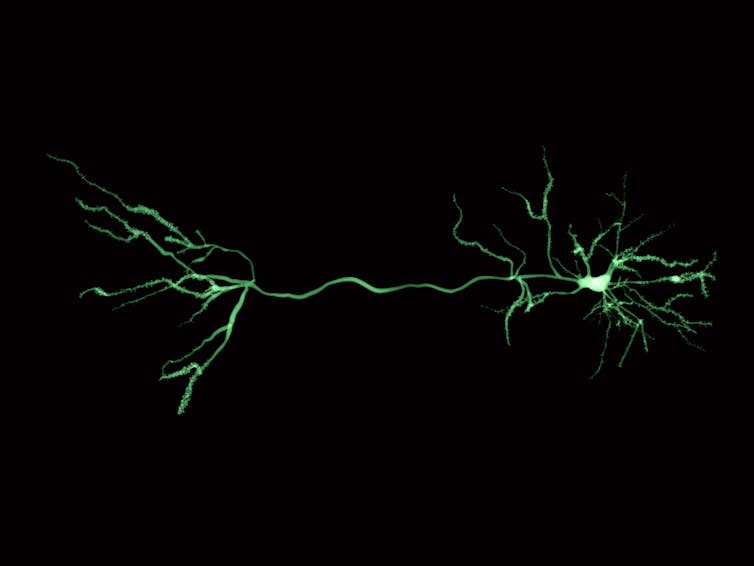 Neuroscience and artificial intelligence can help improve each other