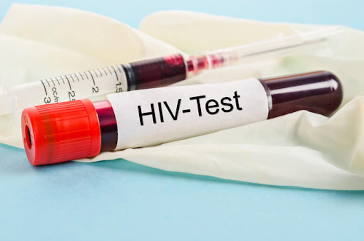 should-you-be-tested-for-hiv-why-june-27-is-a-good-day-to-do-it