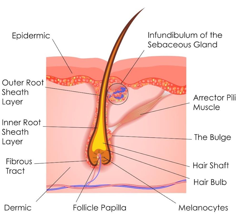 Laser Hair Removal