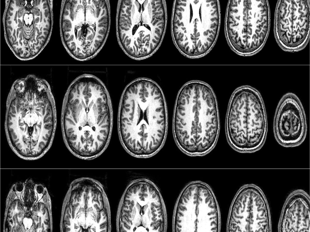 Neurosains Terorisme Temuan Dari Riset Perdana Tentang Pemindaian Otak Orang Orang Radikal Neurosains Terorisme Temuan Dari Riset Perdana Tentang Pemindaian Otak Orang Orang Radikal