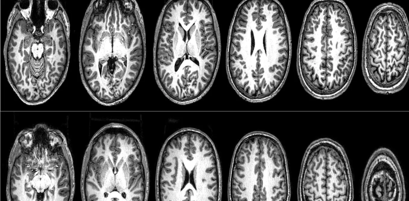 Neurosains Terorisme Temuan Dari Riset Perdana Tentang Pemindaian Otak Orang Orang Radikal