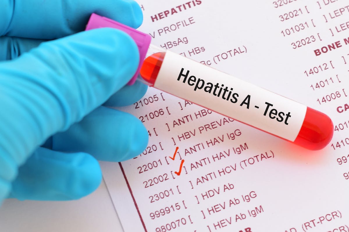 Penyebaran Hepatitis A Di Pacitan Apa Pemicunya Dan Bagaimana Hindari Penularan