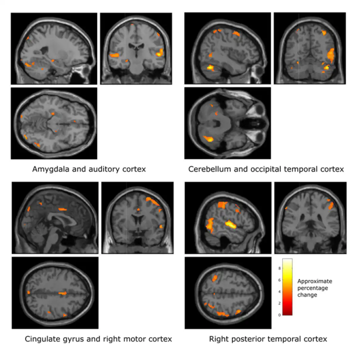 Our brain-computer interfacing technology uses music to make people happy