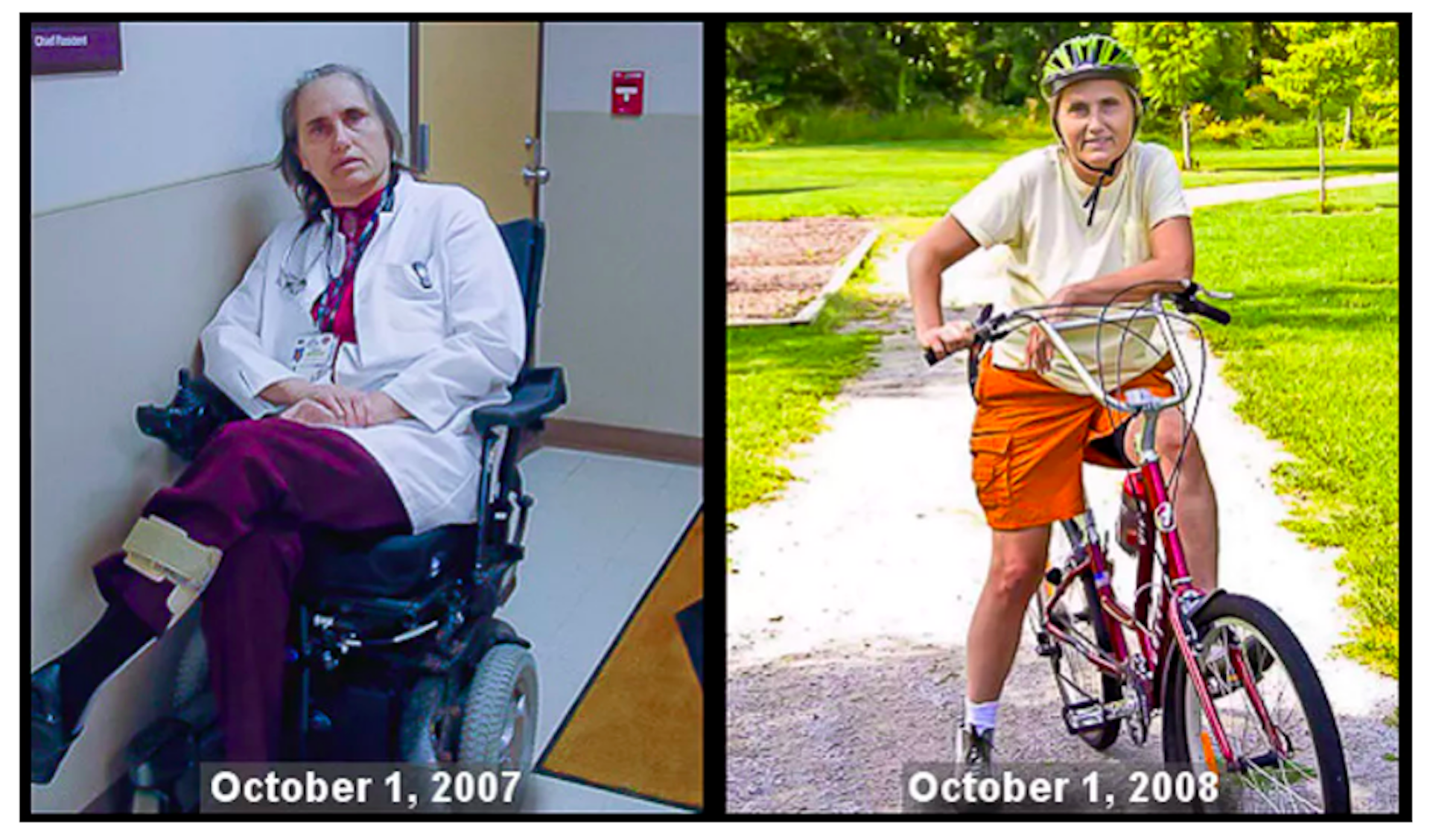 http://theconversation.com/out-of-my-wheelchair-and-back-on-my-bike-why-im-putting-ms-diet-to-the-test-116455