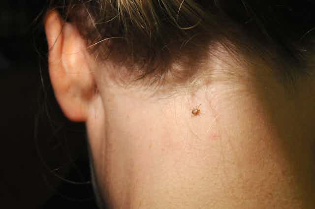 Les Tiques Se Repandent Beaucoup Plus Que Vous Ne Le Pensez Et Elles Transmettent Bien Pire Que La Maladie De Lyme Les Tiques Se Repandent Beaucoup Plus Que Vous Ne Le Pensez Et Elles Transmettent Bien Pire Que La Maladie De Lyme