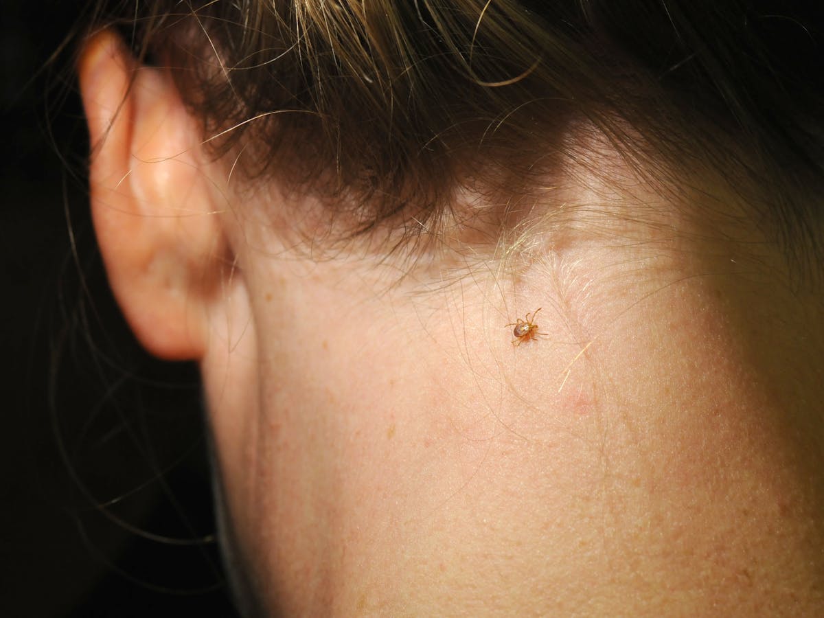 Les Tiques Se Repandent Beaucoup Plus Que Vous Ne Le Pensez Et Elles Transmettent Bien Pire Que La Maladie De Lyme Les Tiques Se Repandent Beaucoup Plus Que Vous Ne Le Pensez Et Elles Transmettent Bien Pire Que La Maladie De Lyme