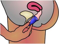 Menstrual cups vs tampons – here's how they compare