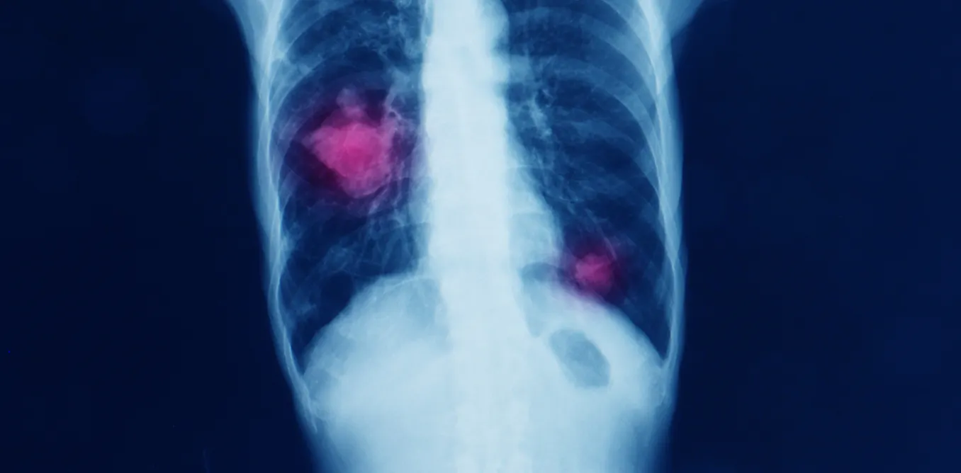 What Exactly Is A Disease
