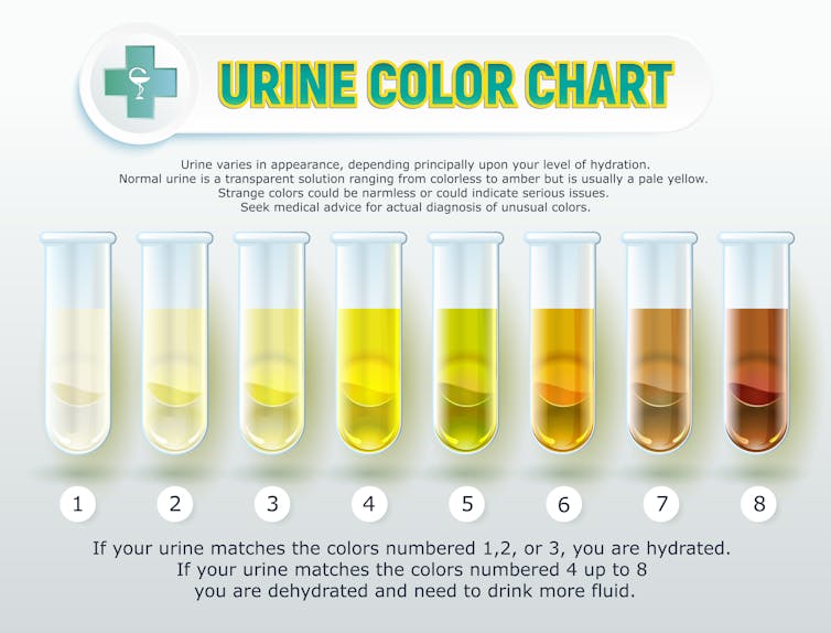 Curious Kids: why is urine yellow?