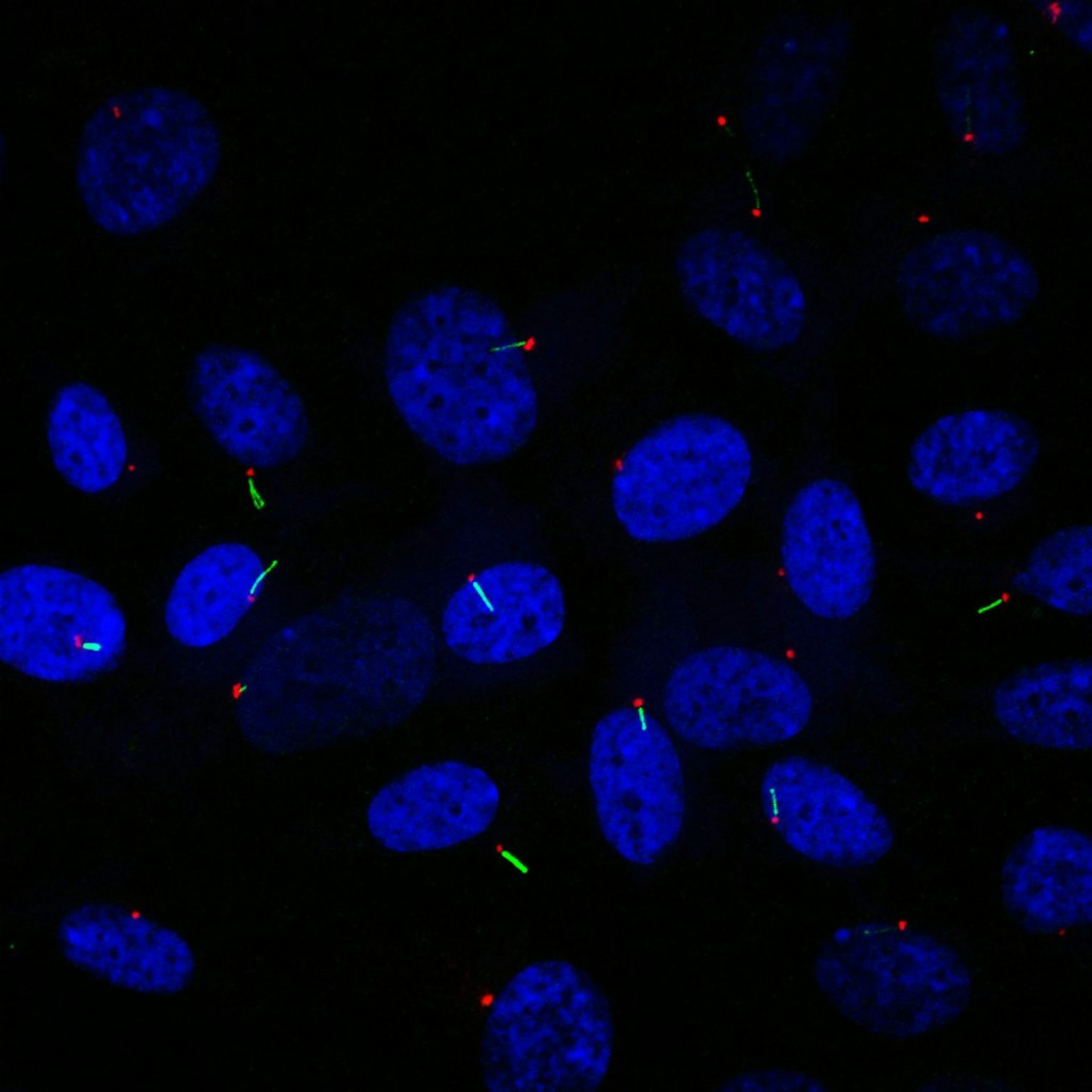 Cilia Cell S Long Overlooked Antenna That Can Drive Cancer Or Stop It In Its Tracks