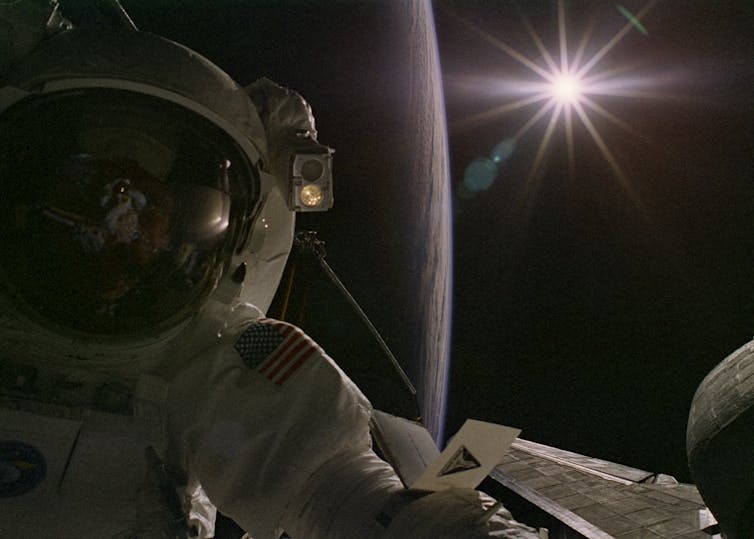 astronauts risk brain damage in outer space