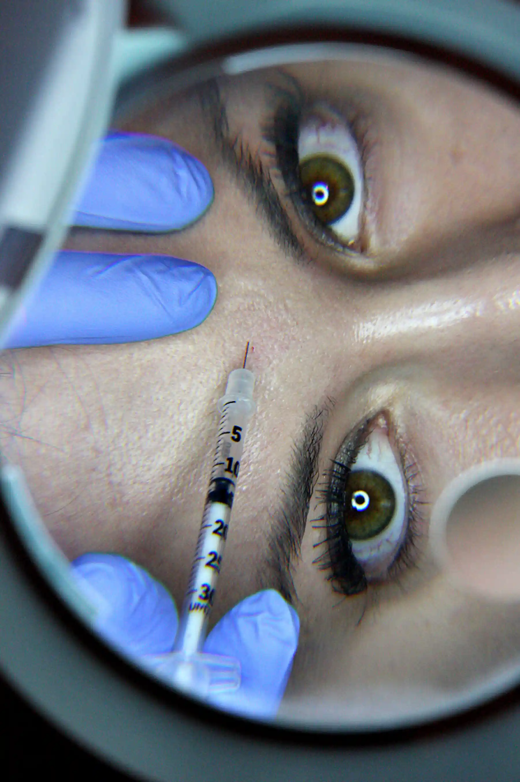 Explainer: the good, the bad and the ugly of botulinum toxin