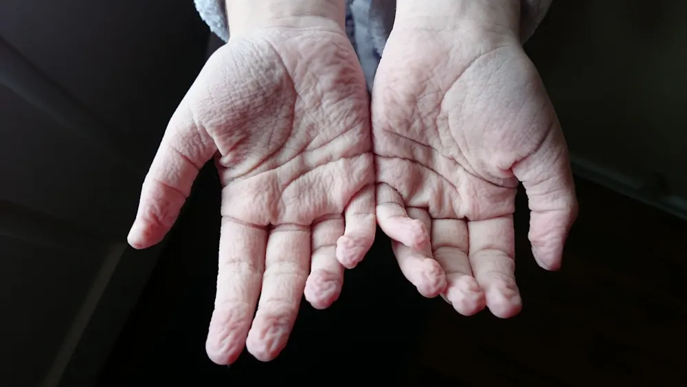 Curious Kids Why Do Our Toes And Fingers Get Wrinkly In The Bath Curious Kids Why Do Our Toes And Fingers Get Wrinkly In The Bath