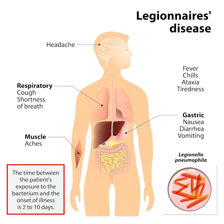 Legionnaires disease poster