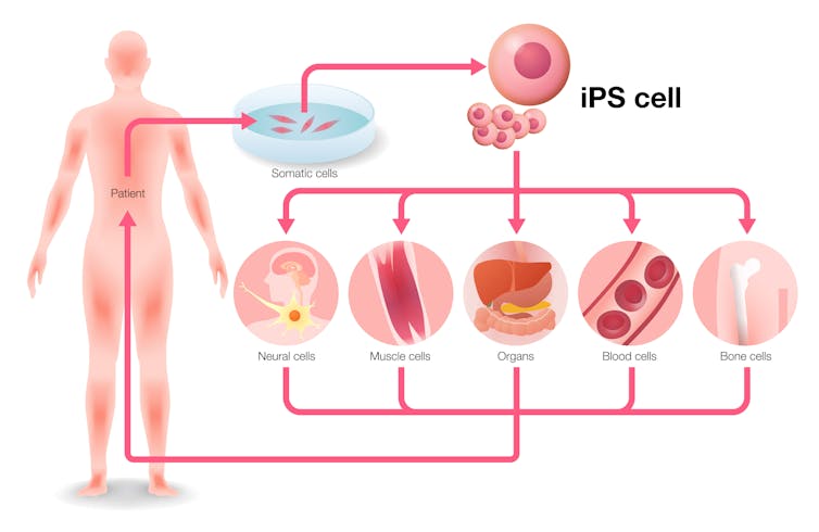 Stem cells could regenerate organs – but only if the body won't reject them