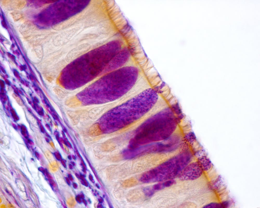 Cilia: cell's long-overlooked antenna that can drive cancer – or stop