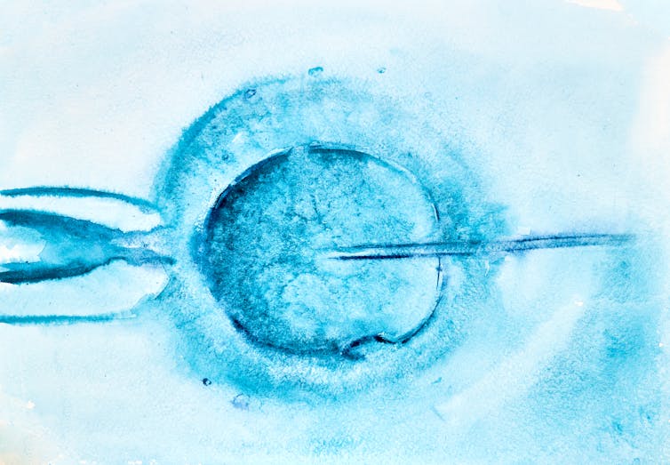 IVF changes babies' genes but these differences disappear by adulthood