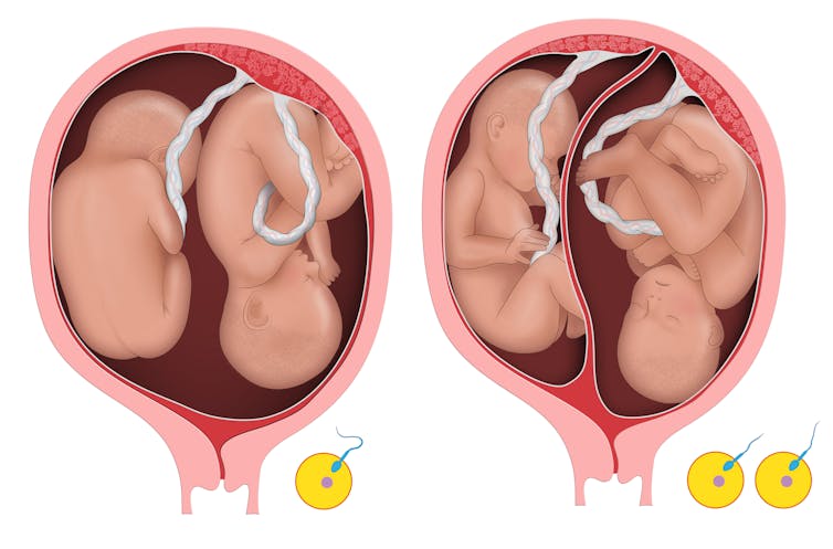 why are some twins identical and some not?