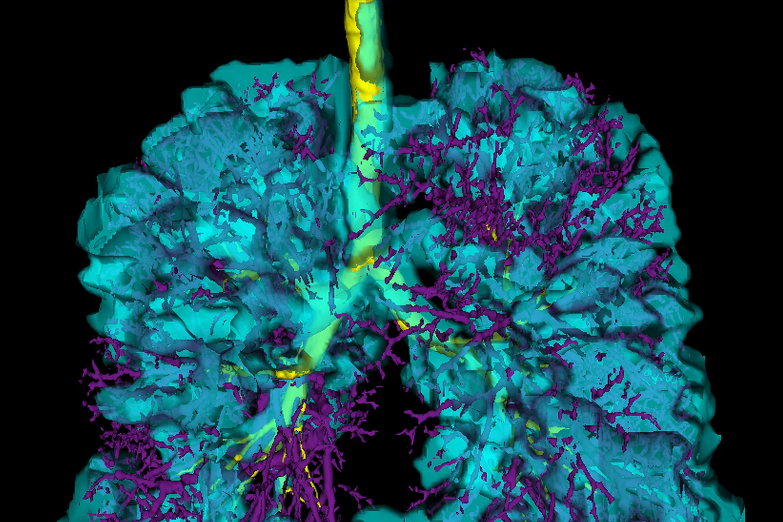 Vaping: As an imaging scientist I fear the deadly impact on people's lungs Vaping: As an imaging scientist I fear the deadly impact on people's lungs