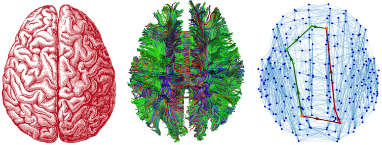 Your brain has 'landmarks' that drive neural traffic and help you make hard decisions