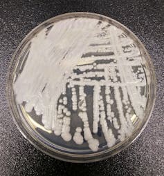 Why does the CDC want us to 'Think Fungus'?
