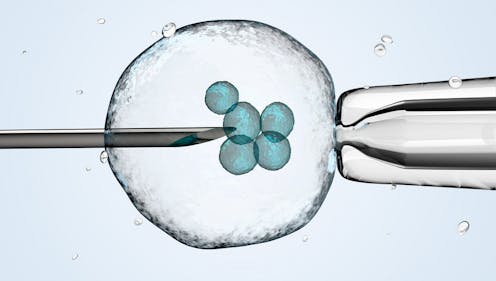 The business of IVF: how human eggs went from simple cells to a valuable commodity